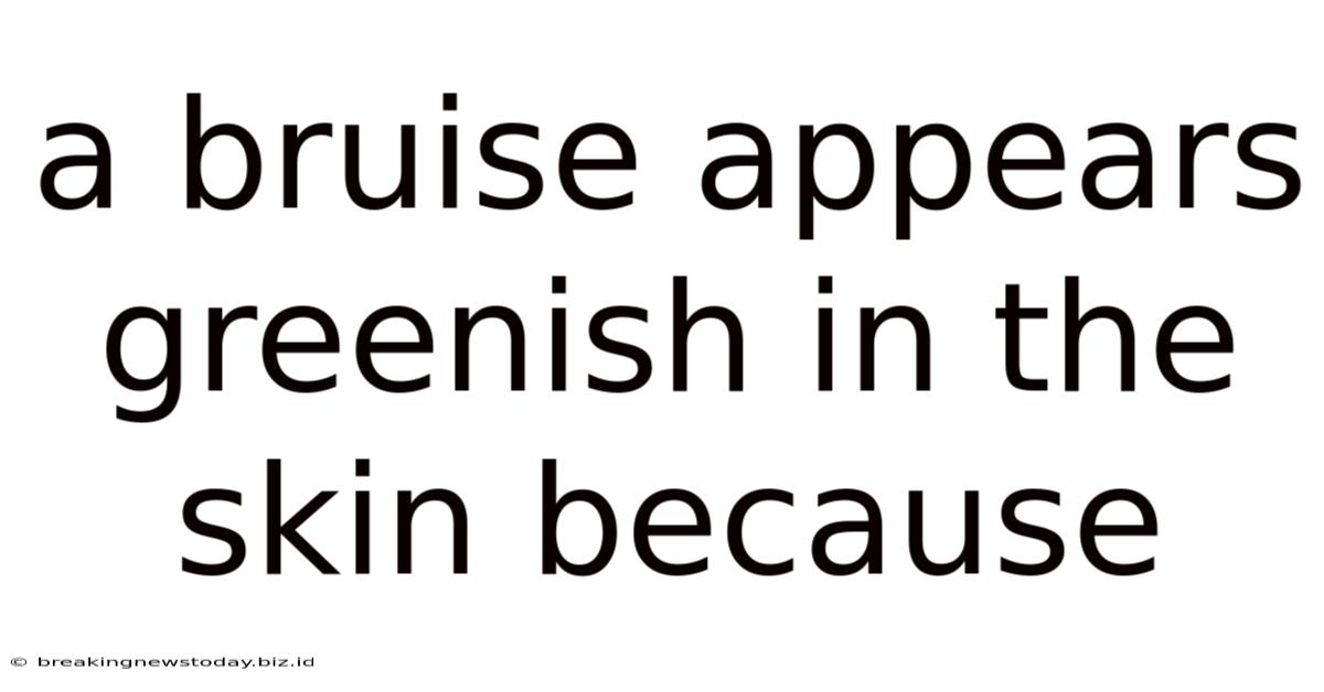 A Bruise Appears Greenish In The Skin Because