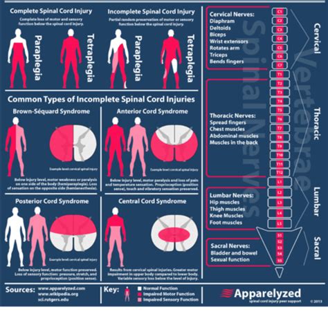 A Spinal Cord Injury At The Level Of C7 Quizlet