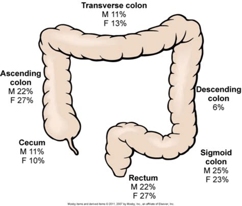 An Early Indicator Of Colon Cancer Is Quizlet