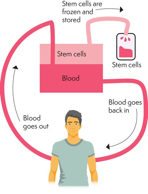 Autologous Stem Cell Transplantation Is A Procedure In Which Quizlet