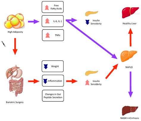 Bariatric Patients Have A Higher Risk Of Inpatient Complications