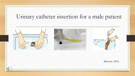 Bladder Retraining Following Removal Of An Indwelling Catheter Begins With