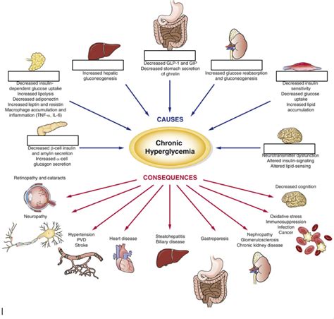 Characteristic Of Type 1 Diabetes Mellitus Quizlet