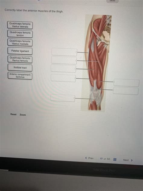 Correctly Label The Anterior Muscles Of The Thigh