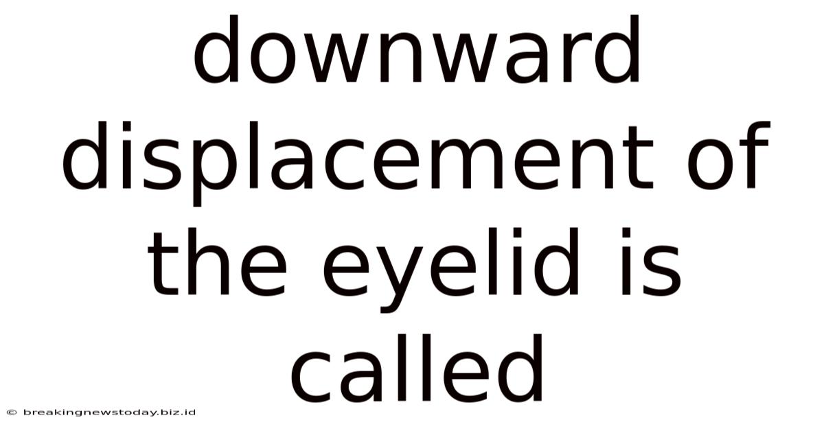 Downward Displacement Of The Eyelid Is Called