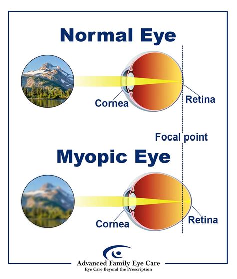 How Is Your Vision Different At Night