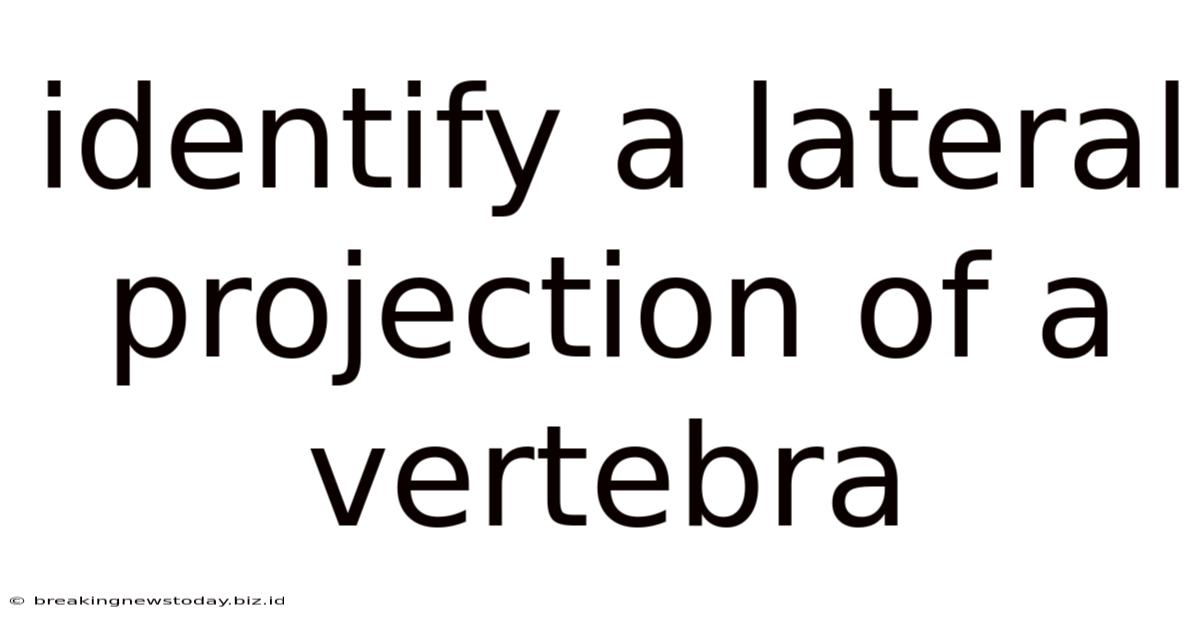 Identify A Lateral Projection Of A Vertebra