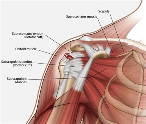 Incorrect Techniques Generally Lead To Ligament And Tendon Damage.