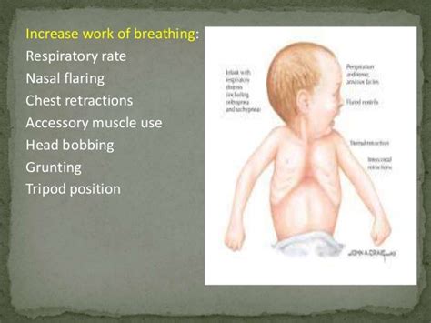 Infants Are Often Referred To As Belly Breathers Because