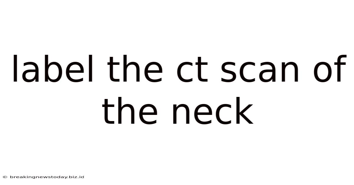 Label The Ct Scan Of The Neck