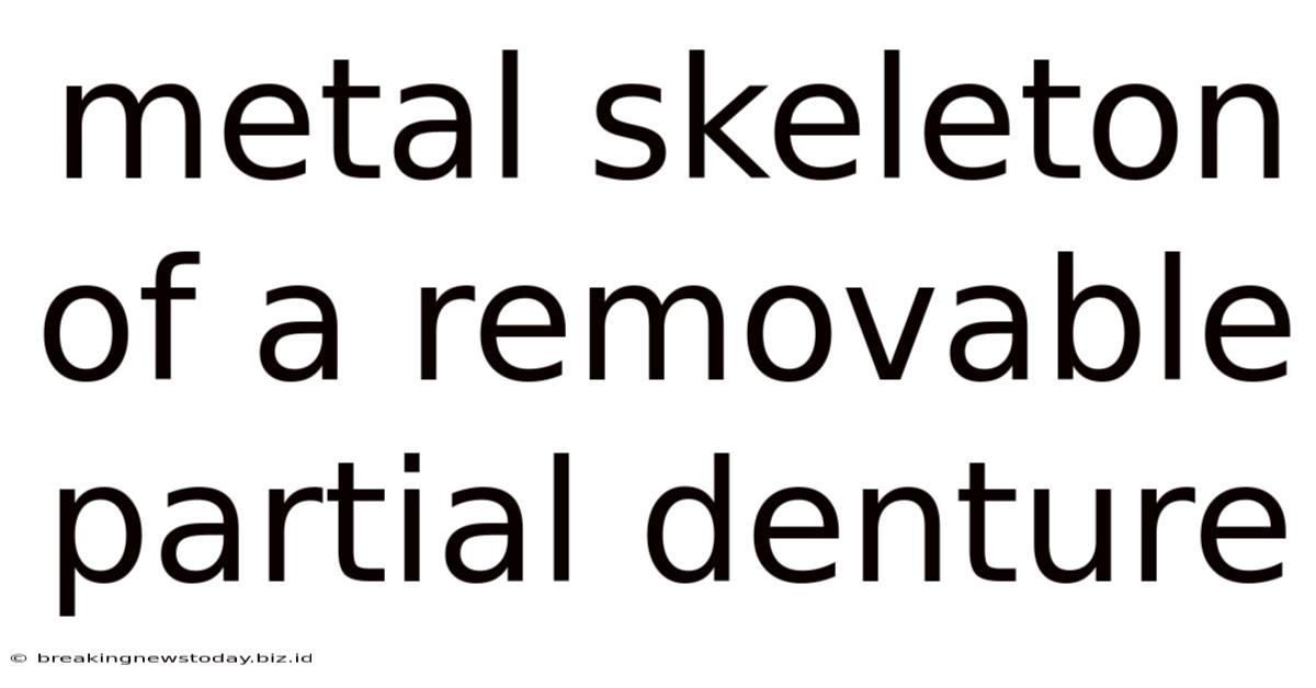 Metal Skeleton Of A Removable Partial Denture