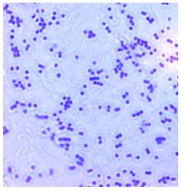 Mrsa Are Staphylococcus Aureus Strains That Are Quizlet