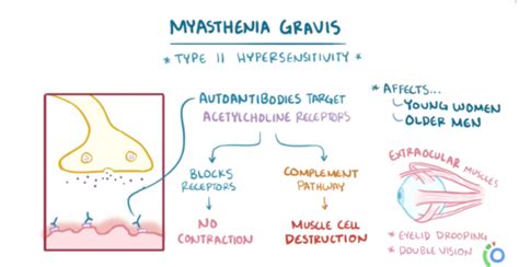 Myasthenia Gravis Is An Autoimmune Disease In Which Quizlet