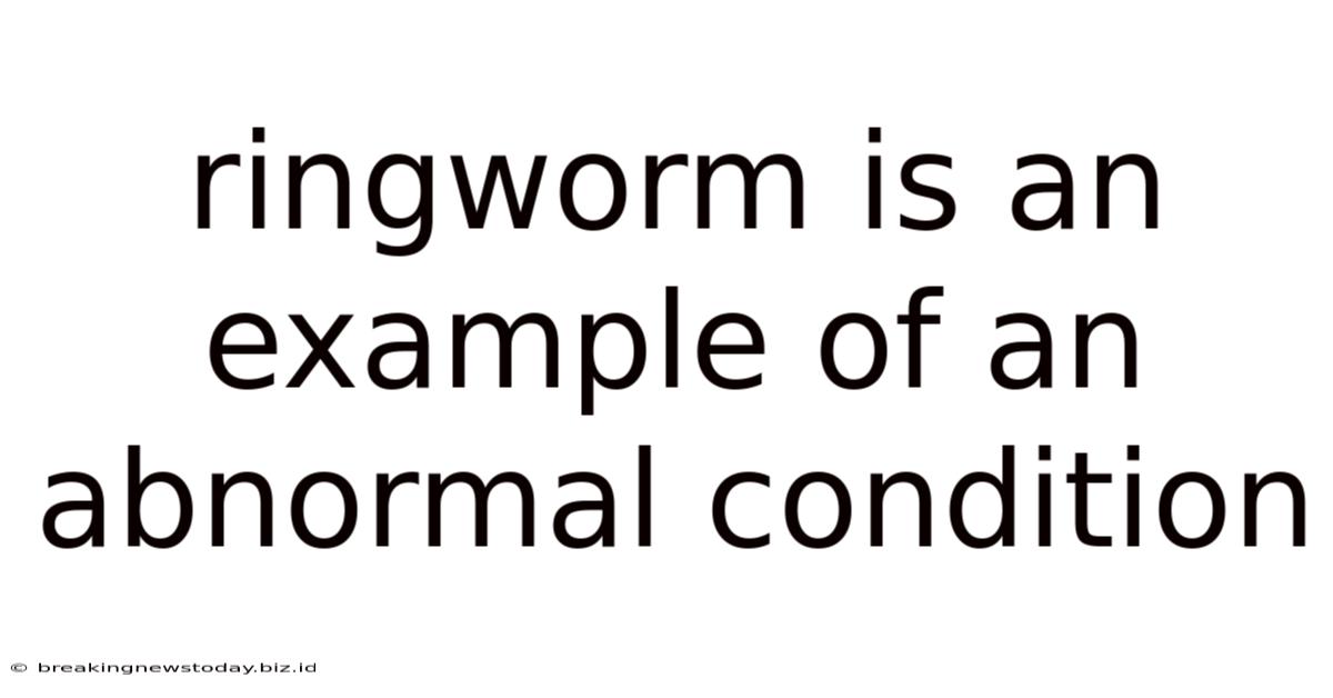 Ringworm Is An Example Of An Abnormal Condition