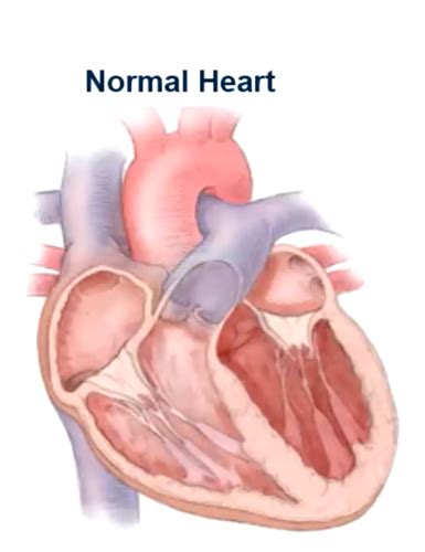 Signs And Symptoms Of Congestive Heart Failure Quizlet