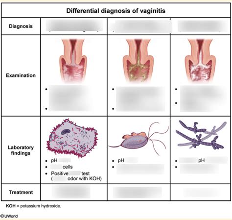 The Most Common Cause Of Vaginitis Is Quizlet