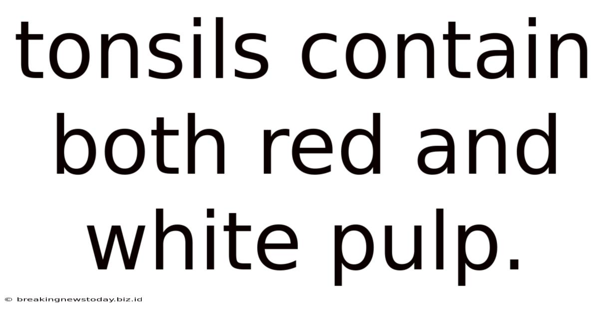 Tonsils Contain Both Red And White Pulp.