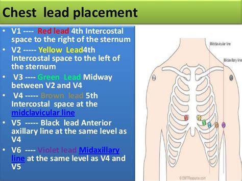 When Preparing To Obtain A 12 Lead Ecg