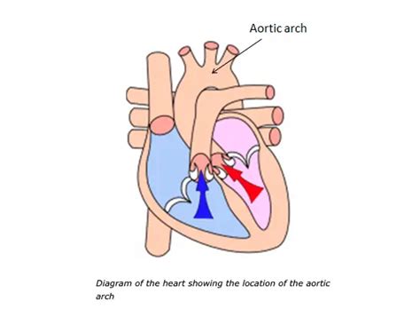 Where Are The Sensors For The Arterial Baroreceptor Reflex Located