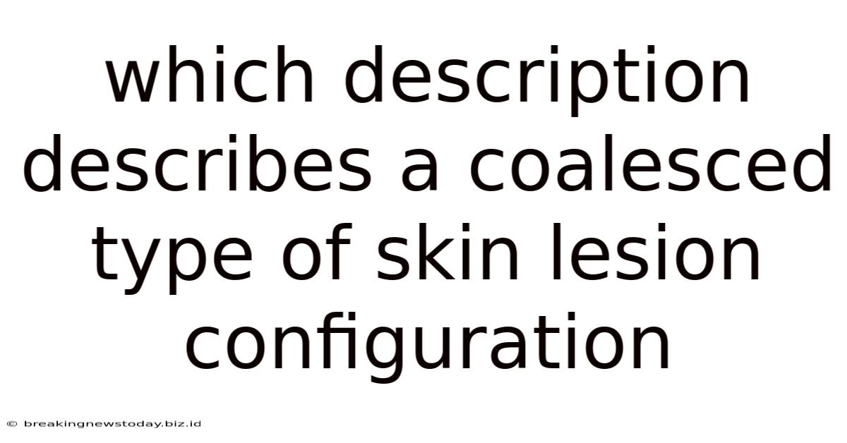 Which Description Describes A Coalesced Type Of Skin Lesion Configuration