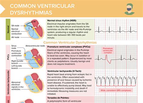 Which Dysrhythmia Is Common In Older Clients