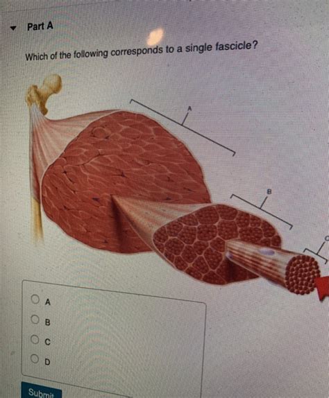 Which Of The Following Corresponds To A Single Fascicle