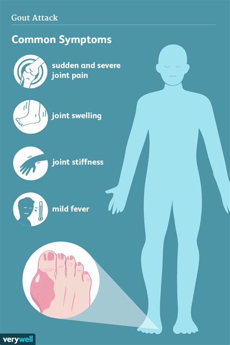 Which Sign Or Symptom Is Associated With Gout Quizlet