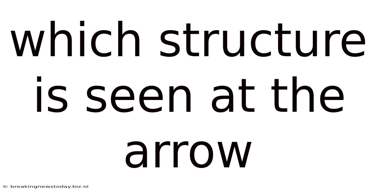 Which Structure Is Seen At The Arrow