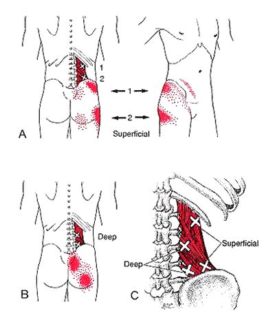 Which Type Of Pain Is Associated With Fibromyalgia Quizlet