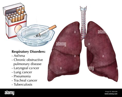 Why Are Smokers More Susceptible To Respiratory Infections Quizlet