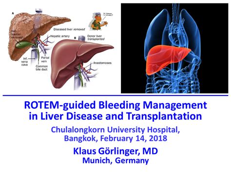 Why Is Liver Dysfunction Associated With Bleeding Disorders