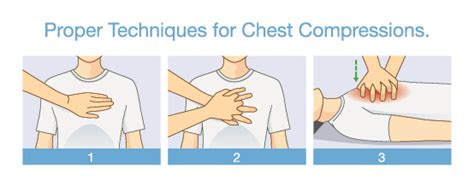 You Notice The Person Giving Chest Compressions